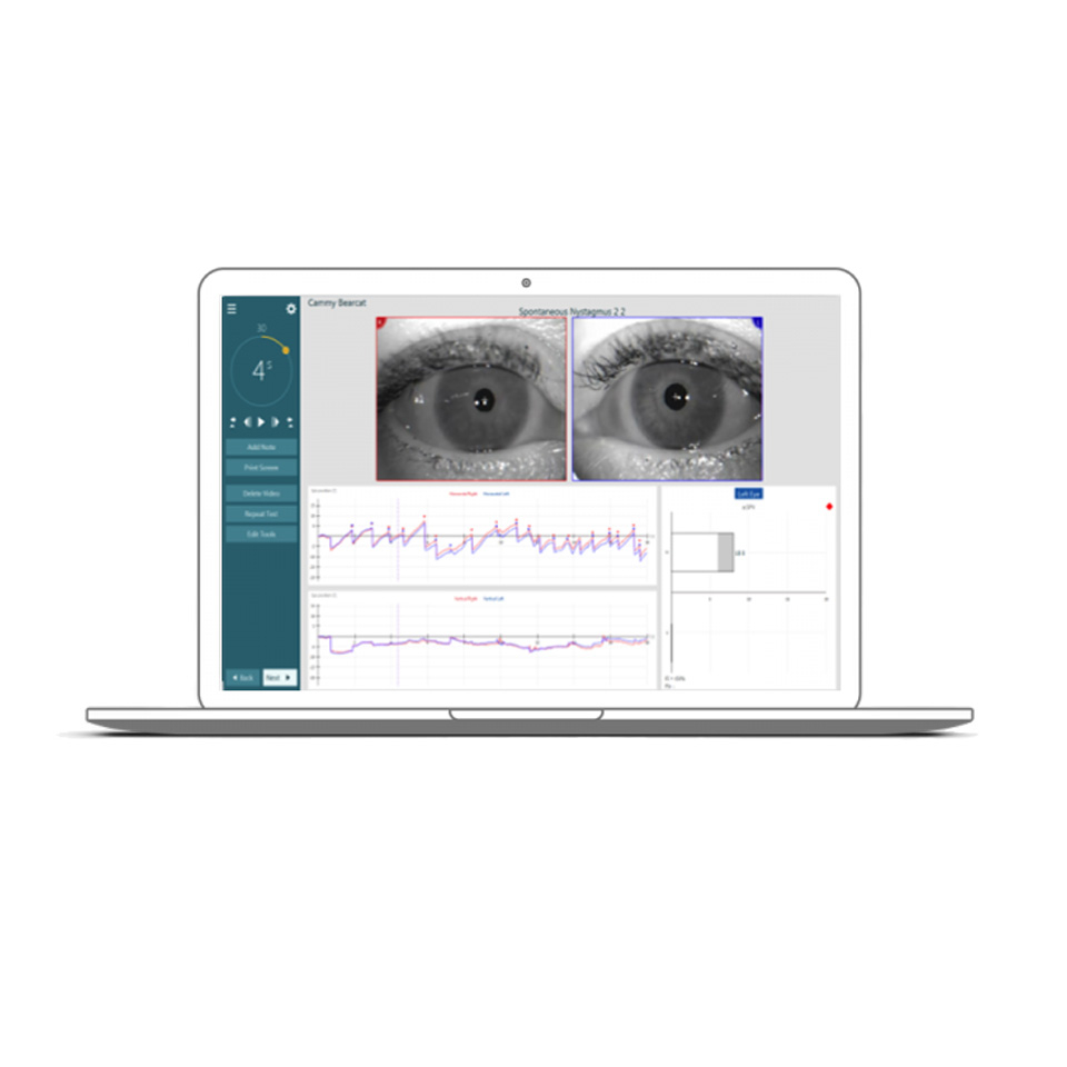 VideoNistagmografia VNG VISUALEYES 515 S USB con PC Desktop